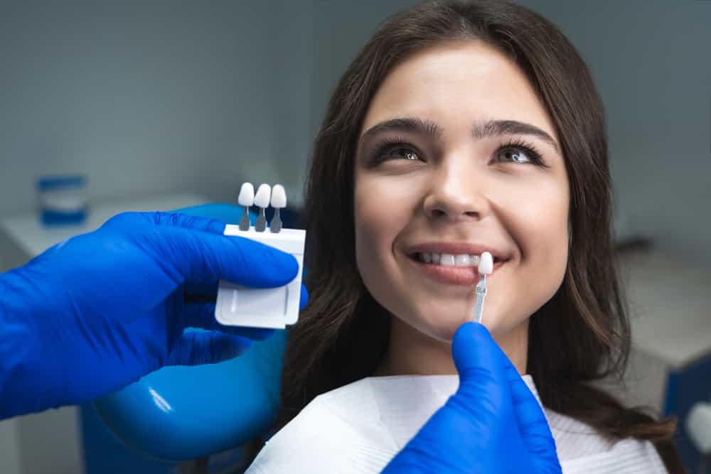 Smile Makeover 101: How Veneers Work