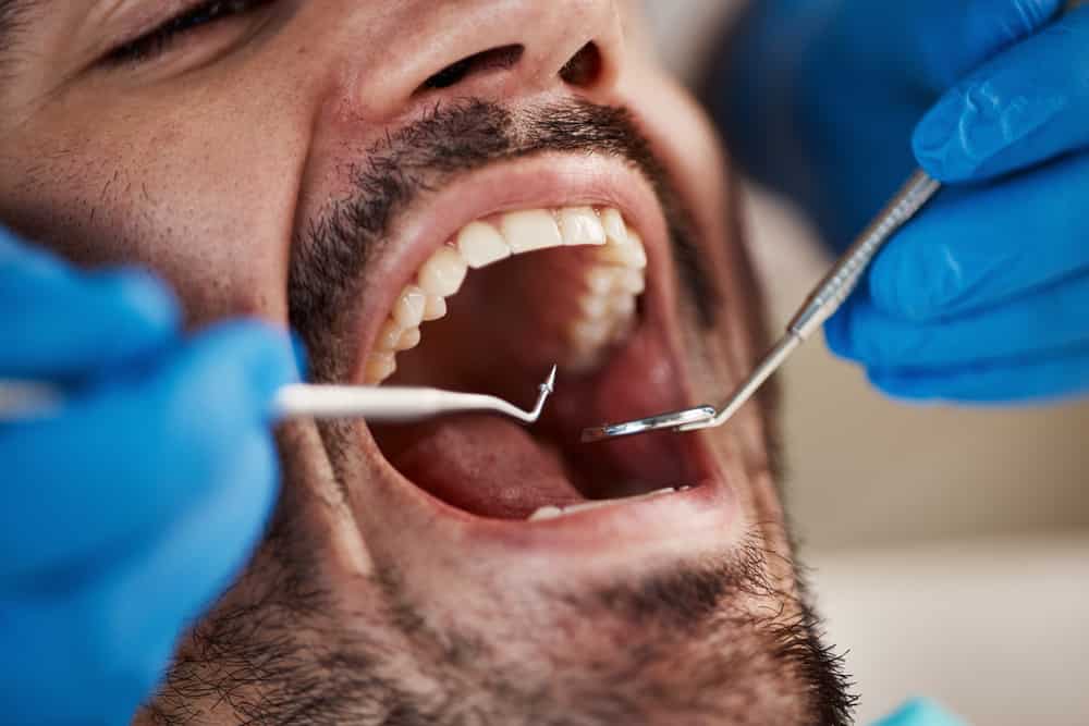 Dental Cleaning