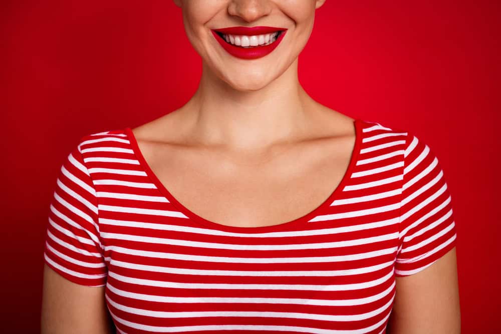 what are composite veneers