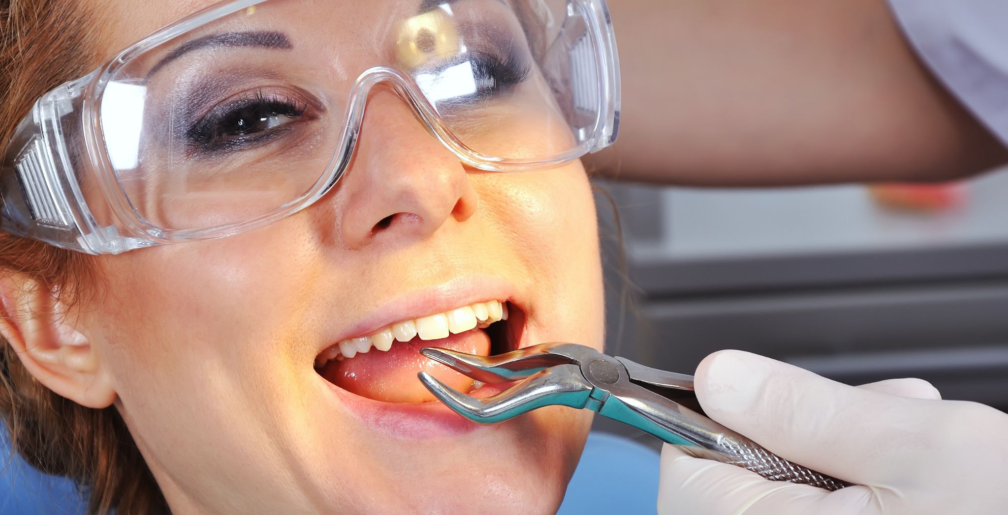 How to Prevent Getting Dry Socket After a Tooth Extraction